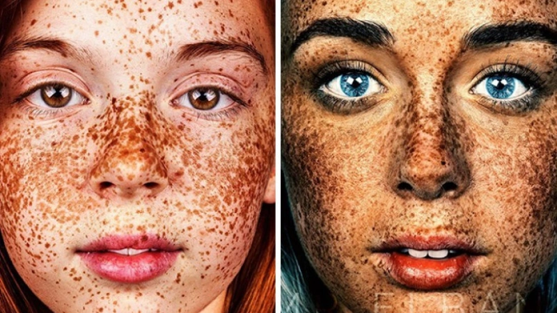 Unique Beauty Of Freckled People Documented By Brock Elbank