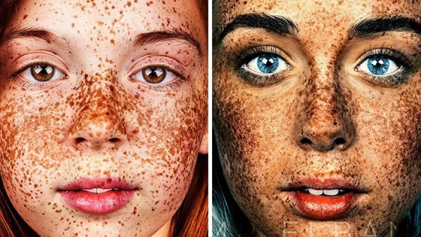 Unique Beauty Of Freckled People Documented By Brock Elbank
