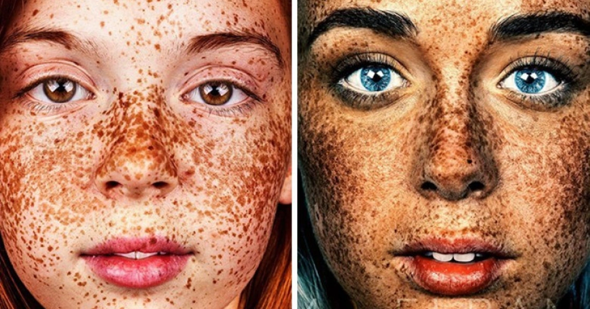 Unique Beauty Of Freckled People Documented By Brock Elbank