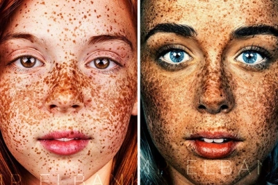 Unique Beauty Of Freckled People Documented By Brock Elbank
