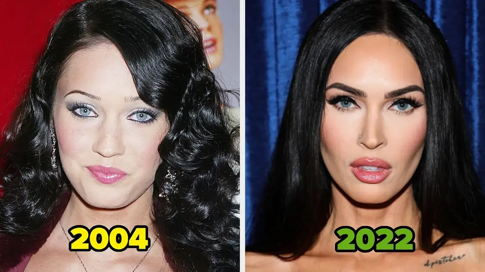 20 Famous People Who Got Unapologetically Candid About Their Plastic Surgery