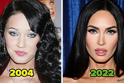20 Famous People Who Got Unapologetically Candid About Their Plastic Surgery