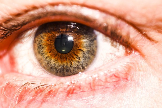 Hazel eyes